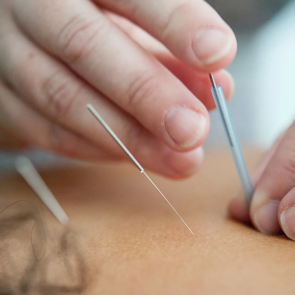 Traditionelle chinesische Medizin & Akupunktur